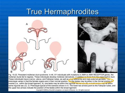 hermaphroditism sex video|'hermaphrodite' Search .